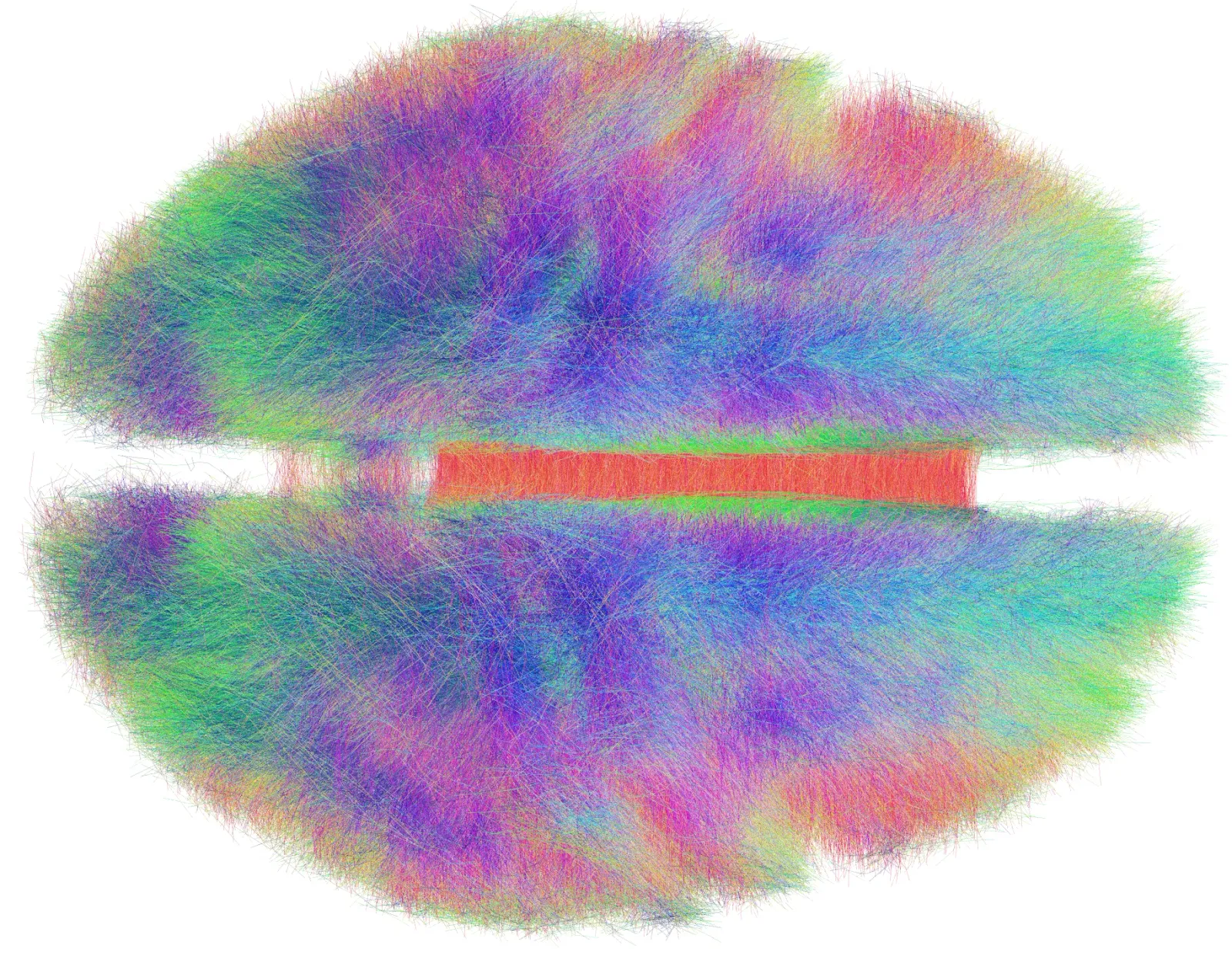 A whole-brain connectome: every long-range white-matter tract reconstructed from diffusion MRI, color-coded by direction. The energetic cost of holding this network at threshold, ready to fire, is what the brain's ~20-watt budget is mostly being spent on. (Image: Andreashorn, CC-BY-SA, via Wikimedia Commons)
