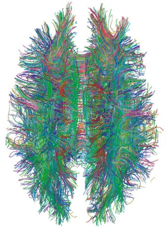 White-matter tractography of a single human brain: the static wiring diagram, frozen at the moment the scan was taken. A frozen-weight LLM is the same situation taken further: a complete, sophisticated network whose connection strengths cannot change at all while it is processing you. (Image: Xavier Gigandet et al., CC-BY 2.5, via Wikimedia Commons)